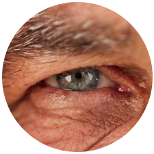 eye closeup